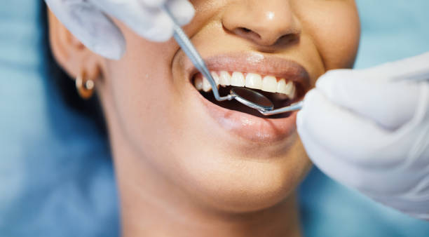Best Urgent Care for Lost Fillings or Crowns in Reading, PA
