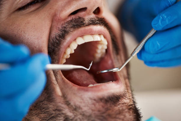 Best Emergency Dental Care for Broken or Chipped Teeth in Reading, PA